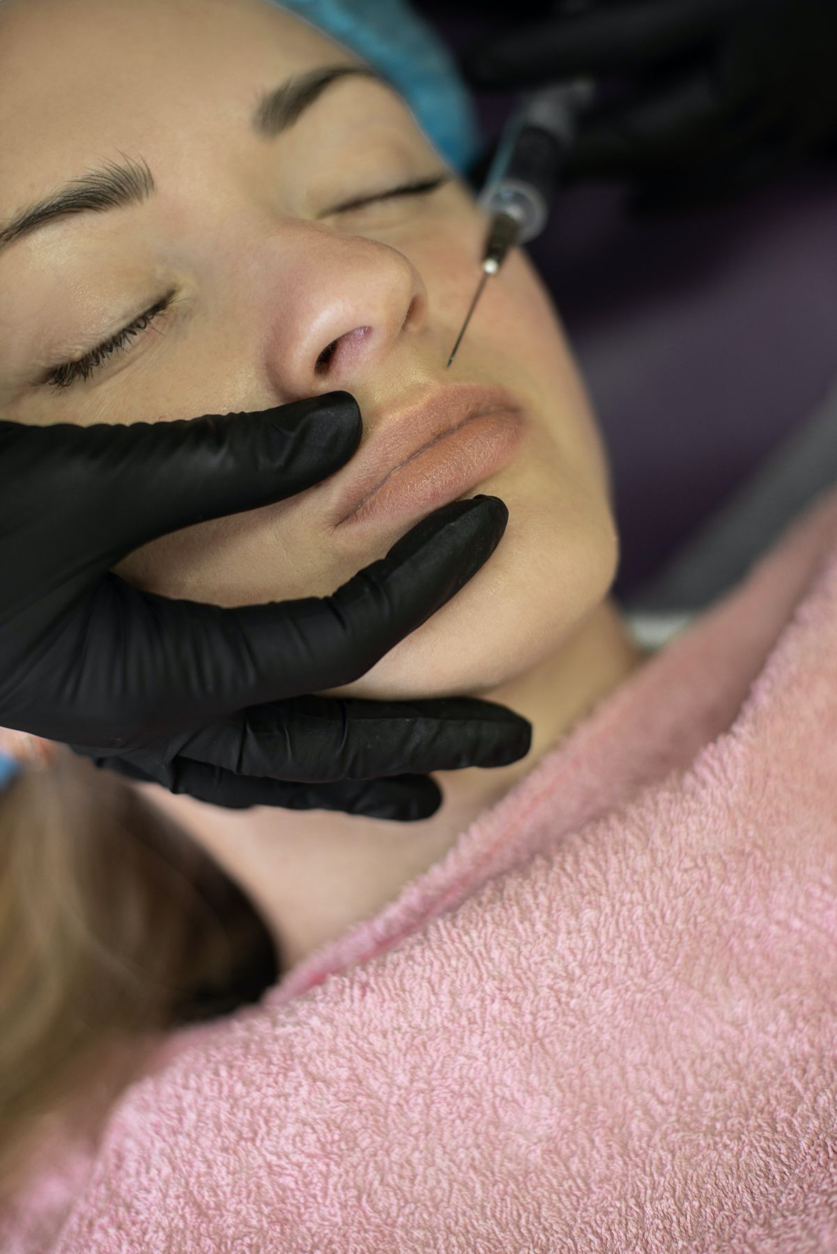 aesthetician injecting botox around a woman's mouth and smile