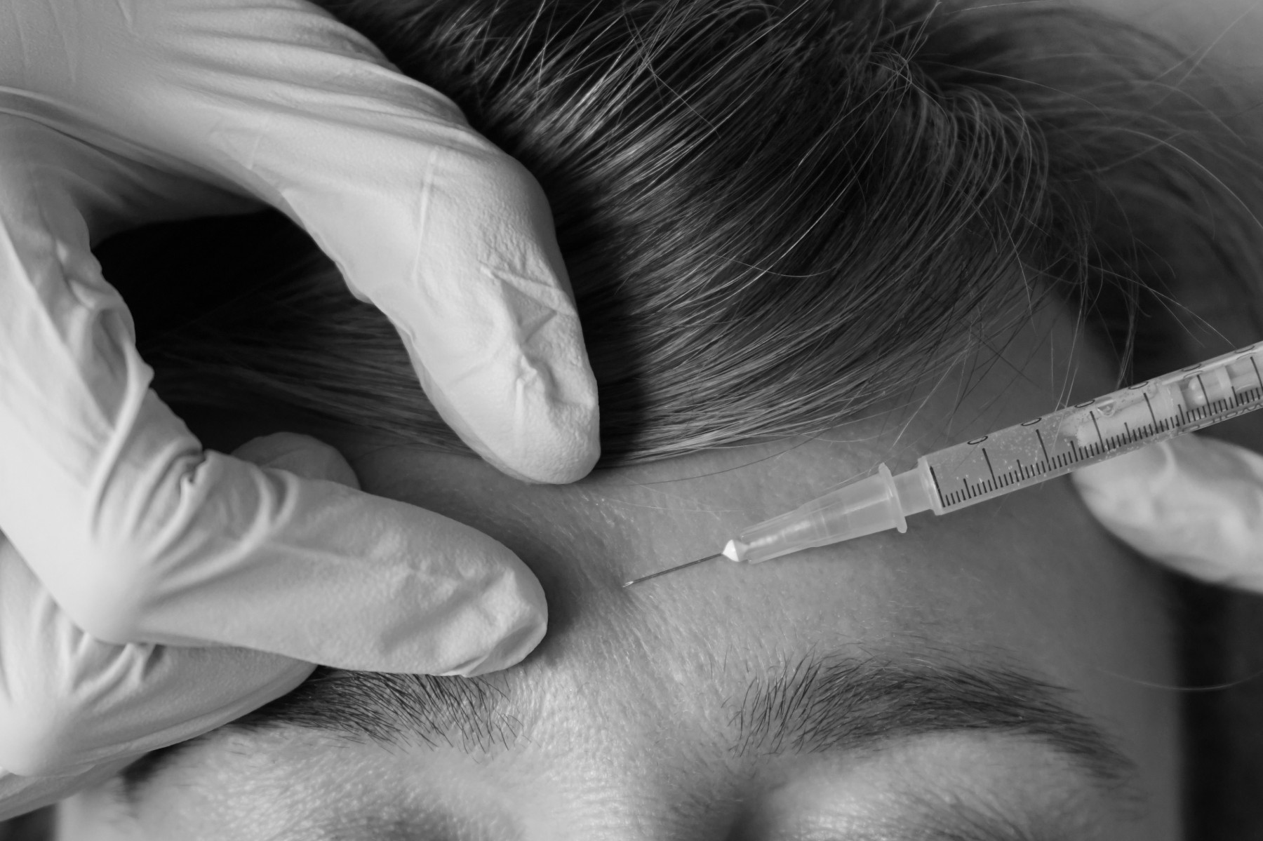 needle injecting cosmetic injection into a woman's forehead at a med spa